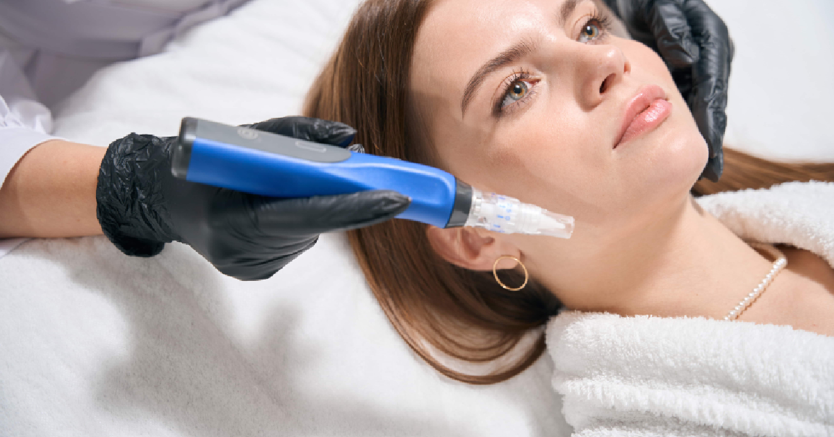 woman lying on a treatment bed as a practitioner wearing black gloves uses a blue SkinPen microneedling device on her cheek to reduce acne scars in Farmingville, NY
