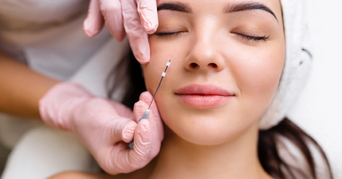 woman receiving a PDO thread lift procedure in Farmingville, NY