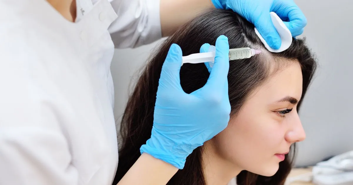 PRF Liquid Therapy for Hair Loss procedure for a patient in Farmingville, NY